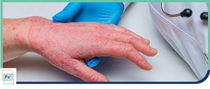Allergy Doctors Near Me in Pembroke Pines, FL Allergy Doctors Near Me in Pembroke Pines, FL