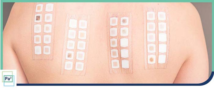 Allergy Patch Test Specialist Near Me in Coral Gables, FL