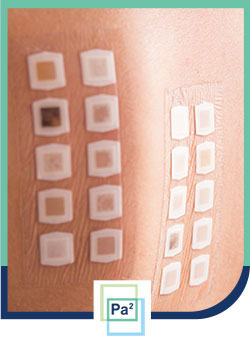 Patch Testing Clinic Near Me in Coral Gables, FL & Palmetto Bay, FL