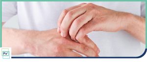 What Are the 5 Stages of an Allergic Reaction? | Piniella Asthma + Allergy in Coral Gables, FL and Palmetto Bay, FL