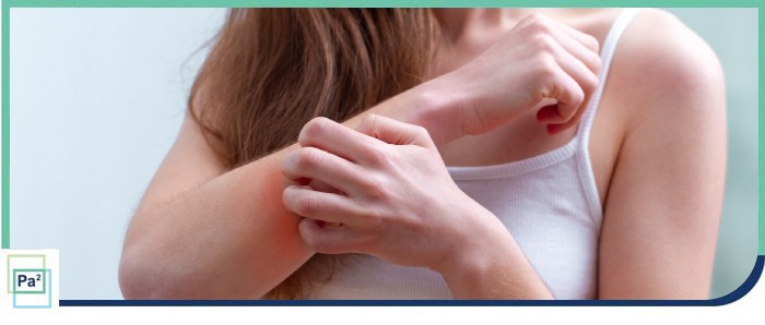 What Causes Itchy Skin and Allergy Rashes? What Causes Itchy Skin and Allergy Rashes?