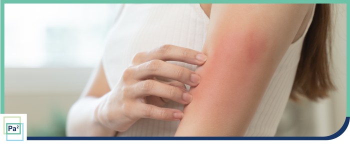 Types of Rashes: Causes, Symptoms, and Care in Palmetto Bay, FL Types of Rashes: Causes, Symptoms, and Care in Palmetto Bay, FL