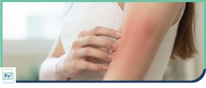 Types of Rashes: Causes, Symptoms, and Care in Palmetto Bay, FL Types of Rashes: Causes, Symptoms, and Care in Palmetto Bay, FL